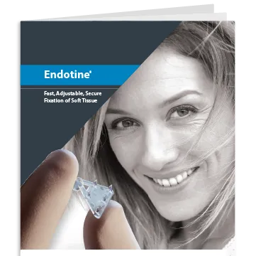 Endotine Brochure Thumb 1